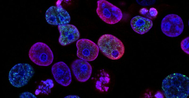 Les Avantages du Régime Méditerranéen pour les Survivants du Cancer : Une Étude Révélatrice