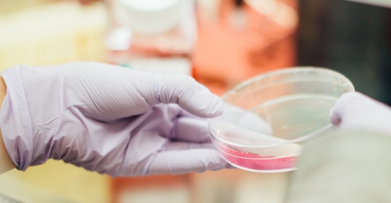 Espoir pour le diagnostic précoce des maladies auto-immunes grâce à l’index d’inflammation systémique