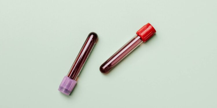 Blood Samples