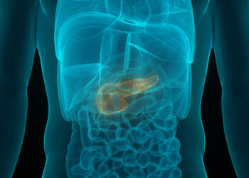 Le régime cétogène, une nouvelle arme contre le cancer du pancréas ?