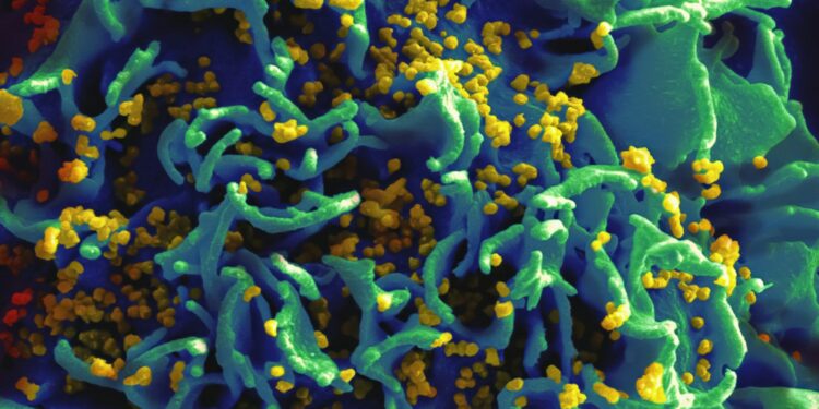 a close up of a blue and yellow substance