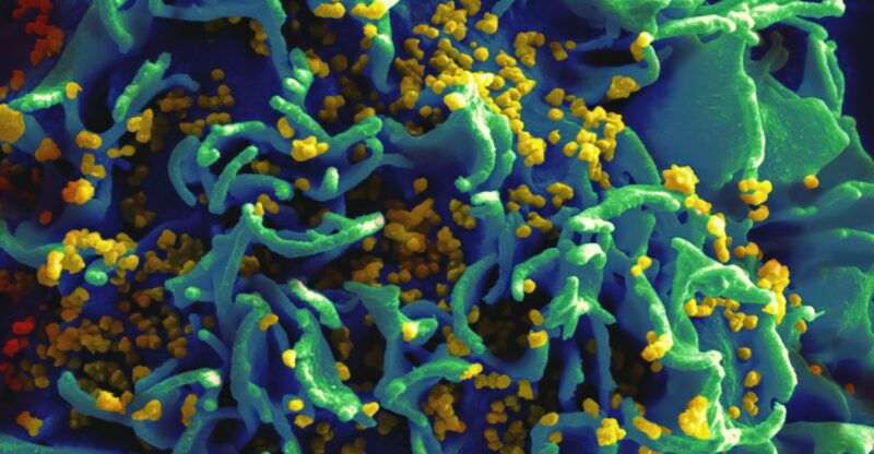 Qu&rsquo;y a-t-il dans le microbiome des aliments que nous consommons ?