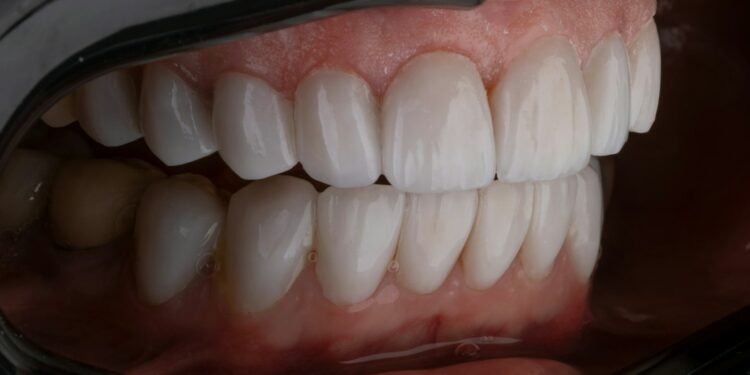 a person's mouth with teeth