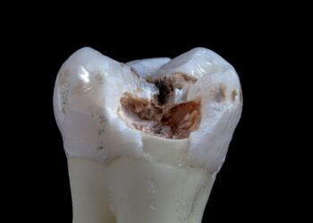 a white substance in a glass