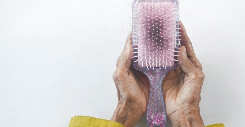 Alopecie androgénique : comment les probiotiques peuvent-ils aider à stimuler la croissance des cheveux ?