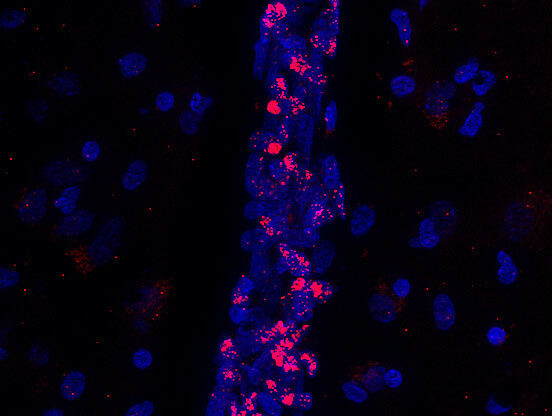 Résistance microvasculaire à l’insuline : comment la carence en CD36 affecte la régulation du glucose