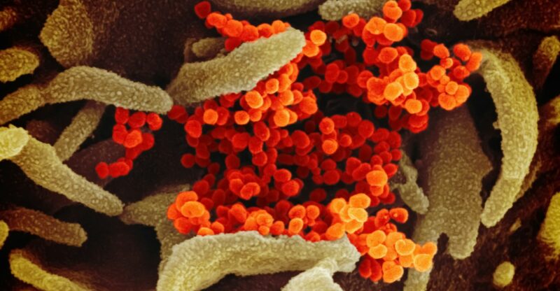 L’homocystéine : un marqueur oublié du risque cardiovasculaire et inflammatoire