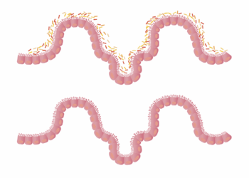 intestines, gut, flora, gut bacteria, intestinal, tract, human, science, biology, intestinal microbiota, medical, health, free image, intestines, gut, gut, gut, gut, gut, gut bacteria