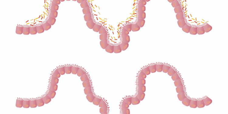intestines, gut, flora, gut bacteria, intestinal, tract, human, science, biology, intestinal microbiota, medical, health, free image, intestines, gut, gut, gut, gut, gut, gut bacteria