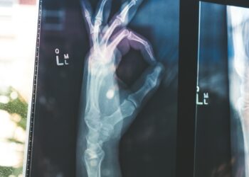 citiscan result hand ok