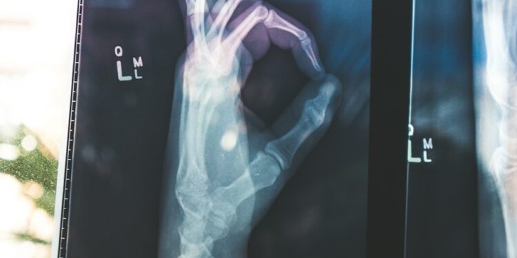 citiscan result hand ok