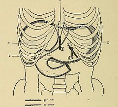 Altération de la bile et dysfonction digestive systémique