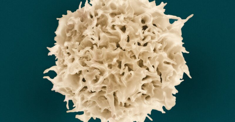 Inflammation des adipocytes et dérèglement métabolique