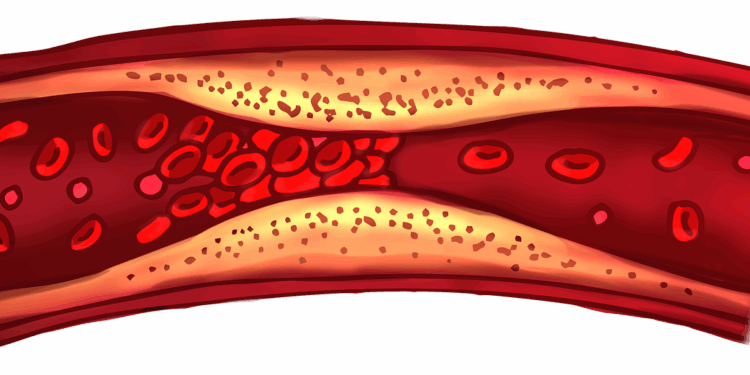 blood clot, vascular, biology, capillary, body, cell, clot, science, blood cell, red blood cell, cutout