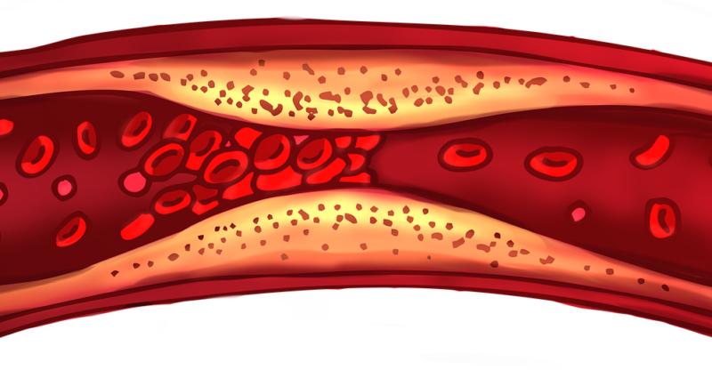 Hyperperméabilité vasculaire