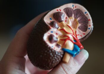 kidney scale model in hand