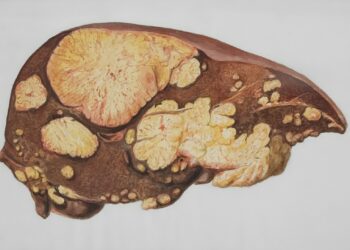 a drawing of a human brain with multiple sections