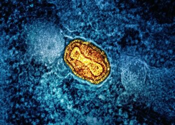 a yellow substance on a blue surface