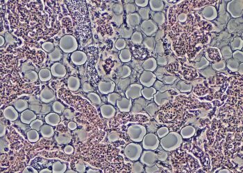 Proliferation of Adipocytes in Adult Parathyroid Gland by Phase Contrast