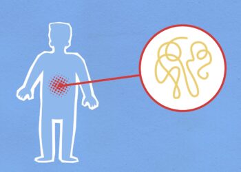 Cutout paper composition representing sick human figure with viral infection in stomach on blue background