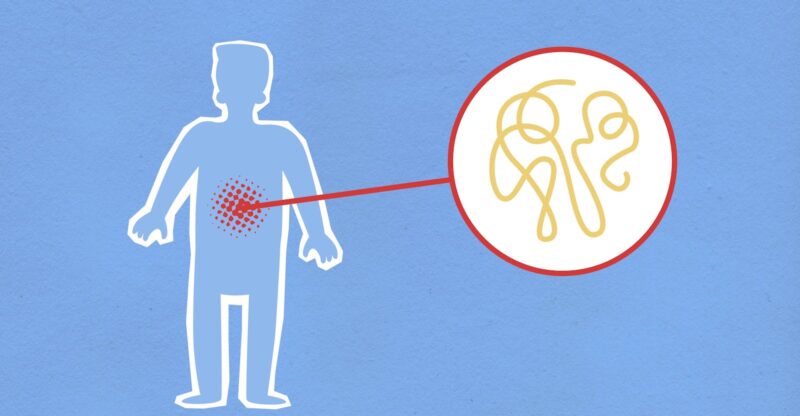 Dysfonction de la production de mucus intestinal