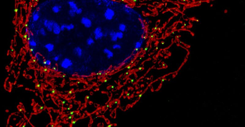 Altération de la signalisation calcique mitochondriale