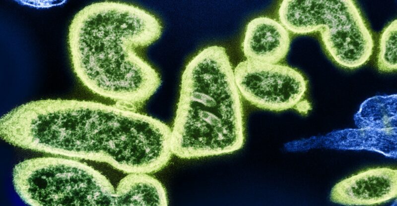 Altération de la dynamique mitochondriale (fusion/fission)