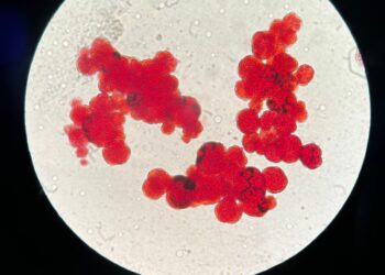 Close-up view of vibrant red microorganisms under a microscope, showcasing cellular detail.