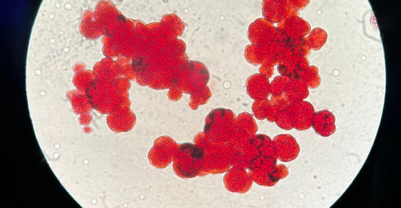 Nitrotyrosine élevée : l’empreinte invisible du stress nitrosatif
