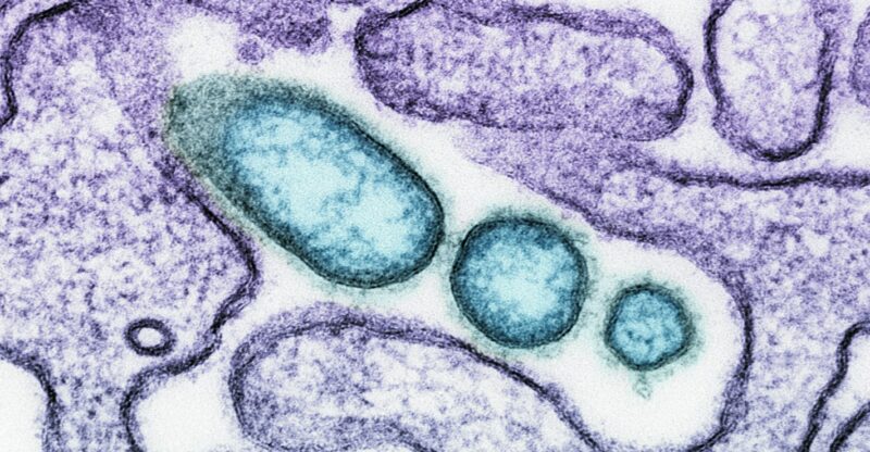 Phosphate mitochondrial : la pièce manquante de la centrale énergétique