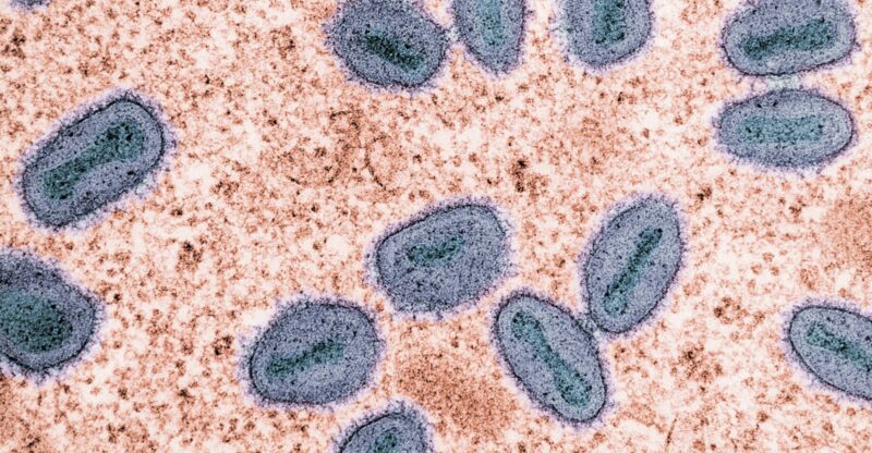 Flexibilité mitochondriale réduite : quand les cellules perdent leur adaptabilité