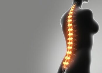 Sciatique et surpoids : l'alimentation peut-elle décharger le nerf sans le « guérir » ?